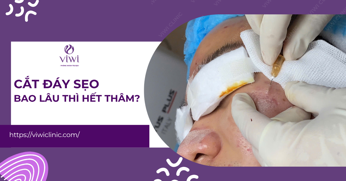 Cắt Đáy Sẹo Bao Lâu Thì Hết Thâm