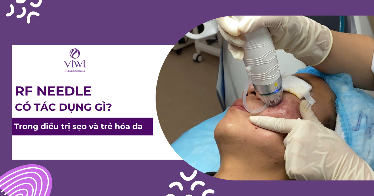 RF Needle có tác dụng gì