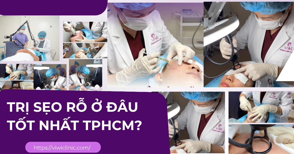Trị Sẹo Rỗ Ở Đâu Tốt Nhất TPHCM?