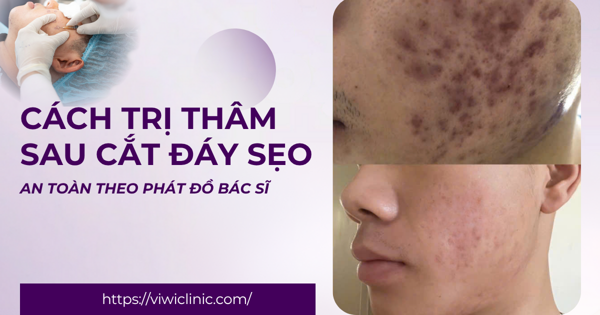 Trị Thâm Sau Cắt Đáy Sẹo