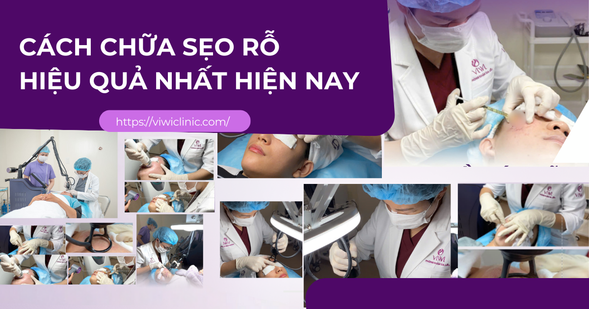 chữa sẹo rỗ