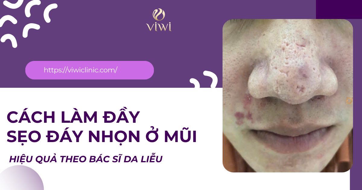 sẹo đáy nhọn ở mũi