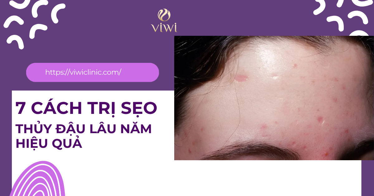 trị sẹo thủy đậu lâu năm